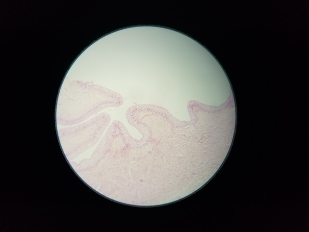 Transitional Epithelium Slides - Transitional Epithelium 01 100X